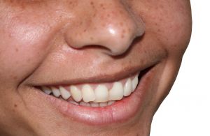 Jak se lpe starat o zuby: Po cel ivot zdrav chrup